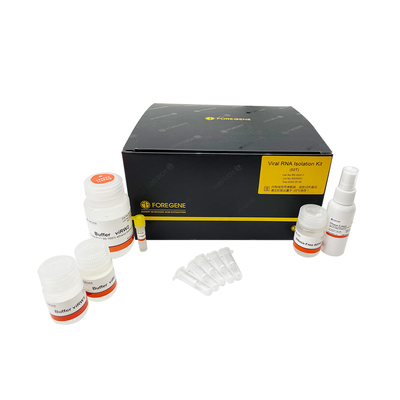 200 부분 RNA 차단은 혈청 200ul으로부터 RNA 가수분해효소 무료 RNA 단지 기둥 높은 RNA 미르나 격리 키트를 장비를 답니다
