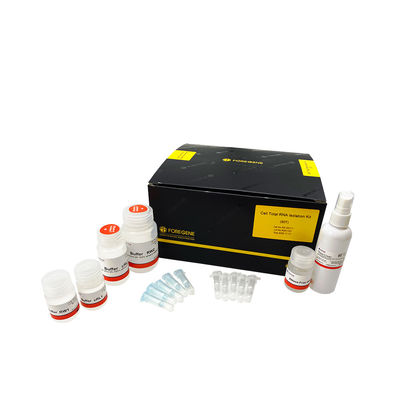 스핀 열 셀 토탈 RNA 차단은 어떤 필요 얼음도 목욕시키지 않는 50 PREP 200 PREP을 장비를 답니다